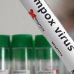 Alerte sanitaire au Mali : cinq cas de Mpox confirmés